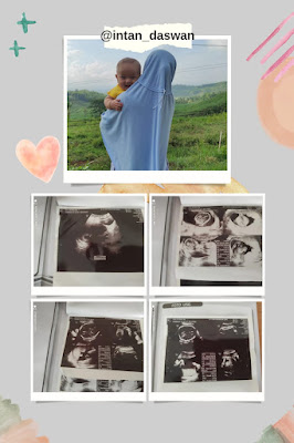 hamil-di-usia-35-+-? hamil anak ketiga